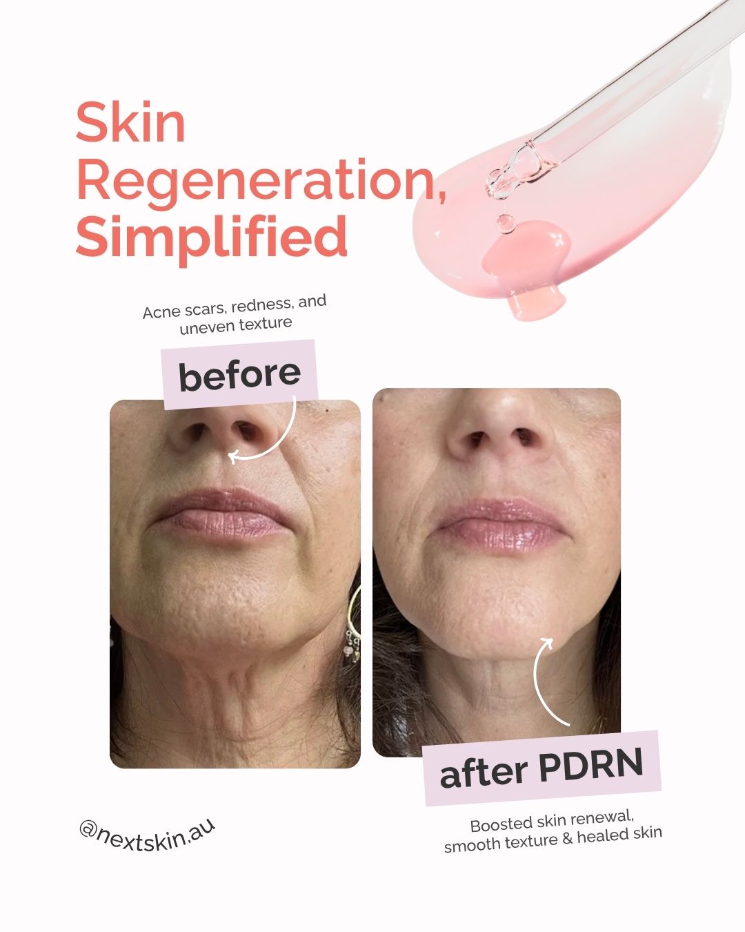 Vegan Pure Renew 20ml skin renewal serum