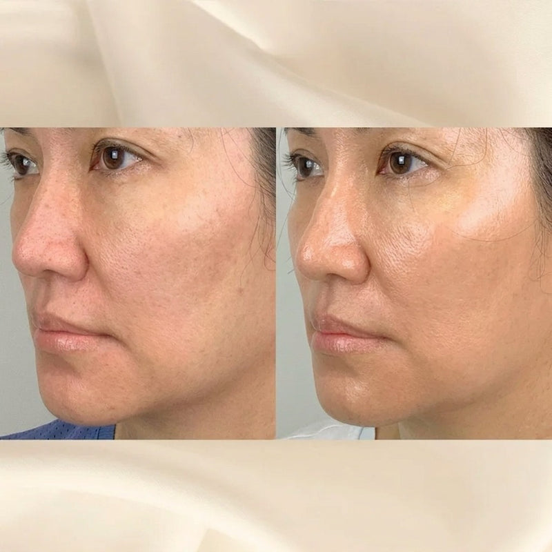 Before and After Result