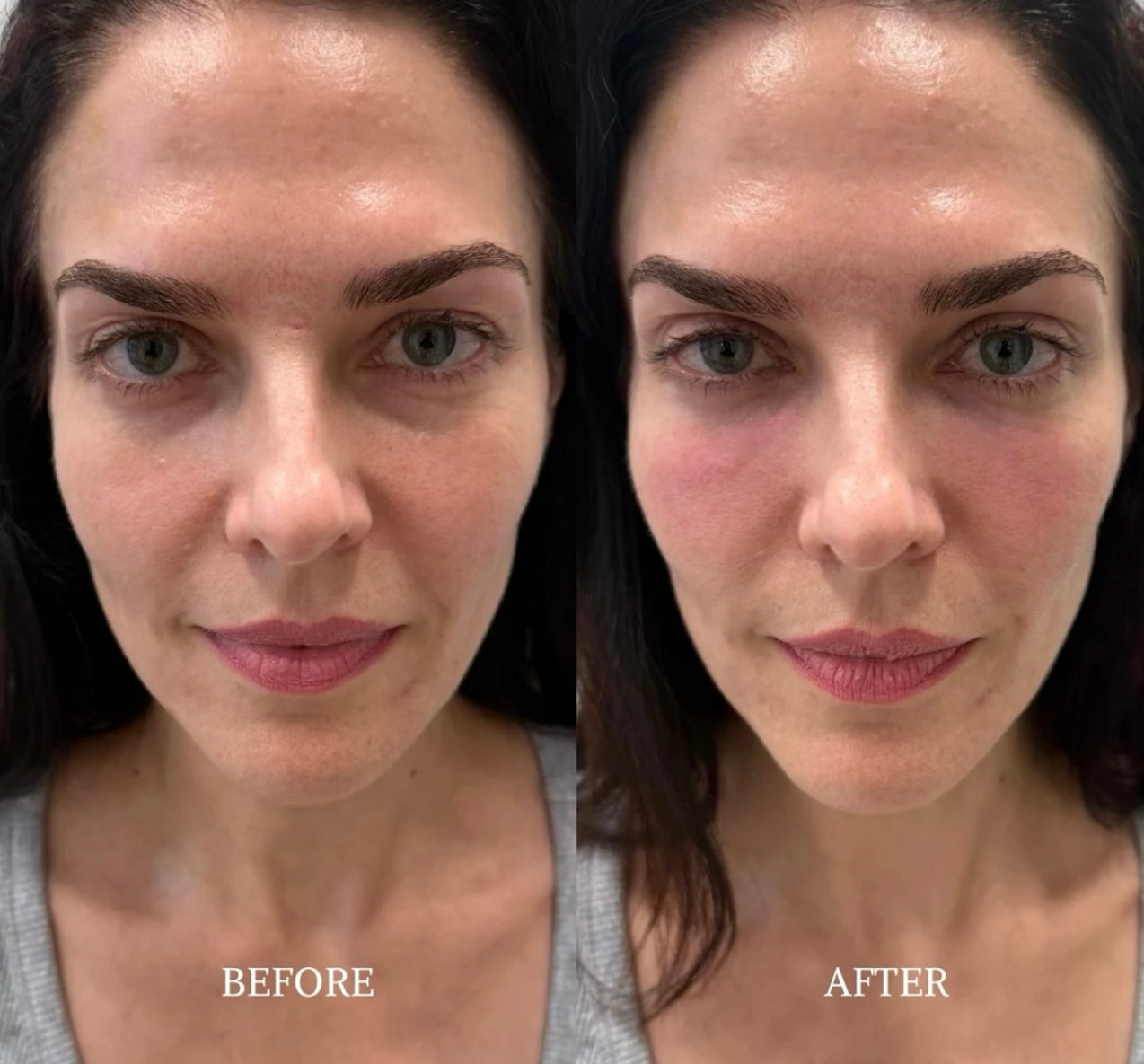 Pulse Renew 20ml micro-spicule renewal serum