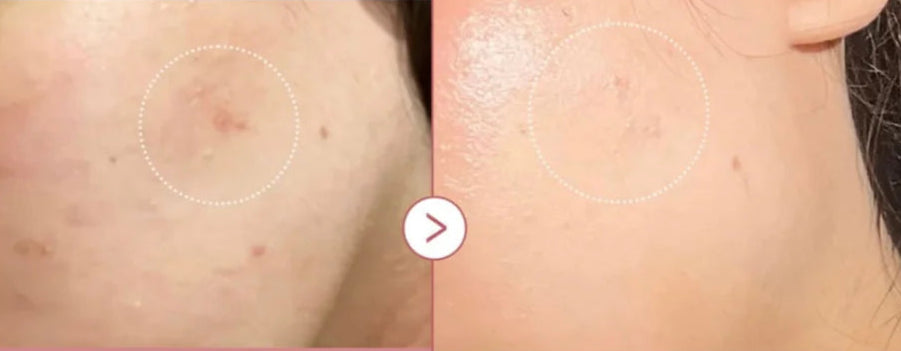 Pulse Renew 20ml micro-spicule renewal serum