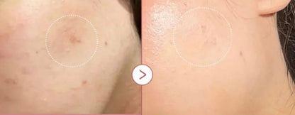 Pulse Renew 20ml micro-spicule renewal serum