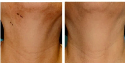Before and After Result
