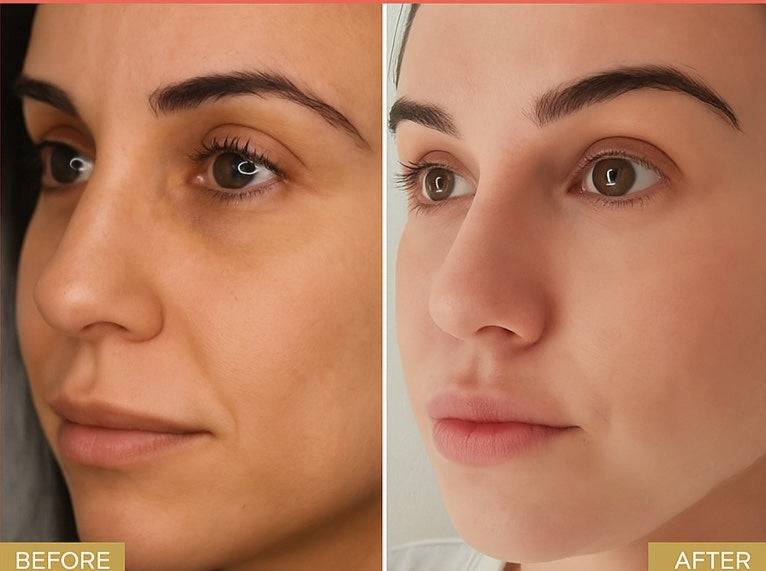 Before and After Result